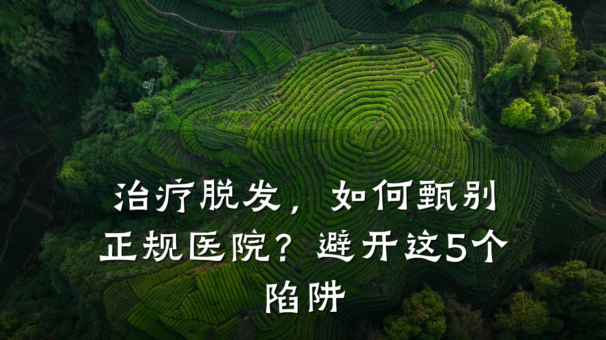 治疗脱发，如何甄别正规医院？避开这5个陷阱